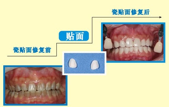 a3449cd0g7972b64c424a&690.jpg