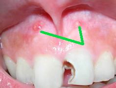 u=1182957479,1215136636&fm=21&gp=0.jpg