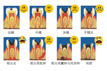 x9xezk.png