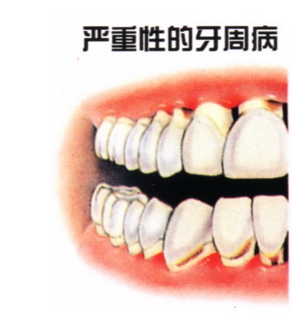 201312061541569612.jpg