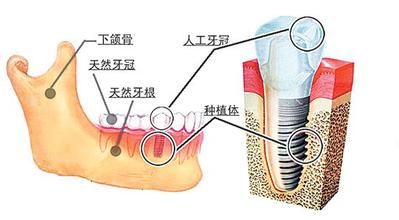 u=1859411300,3836731382&fm=21&gp=0.jpg