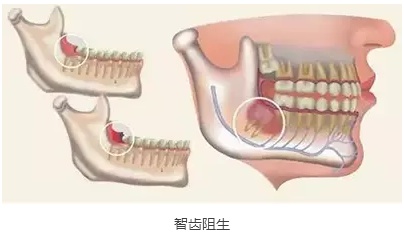 QQ截圖20161103165251.png