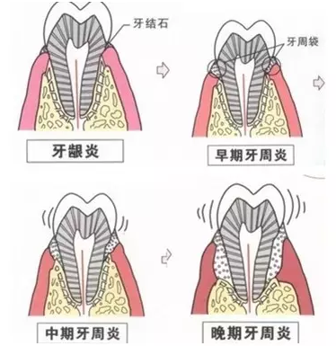 QQ截圖20161108164158.png