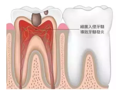 QQ截圖20170117140404.png