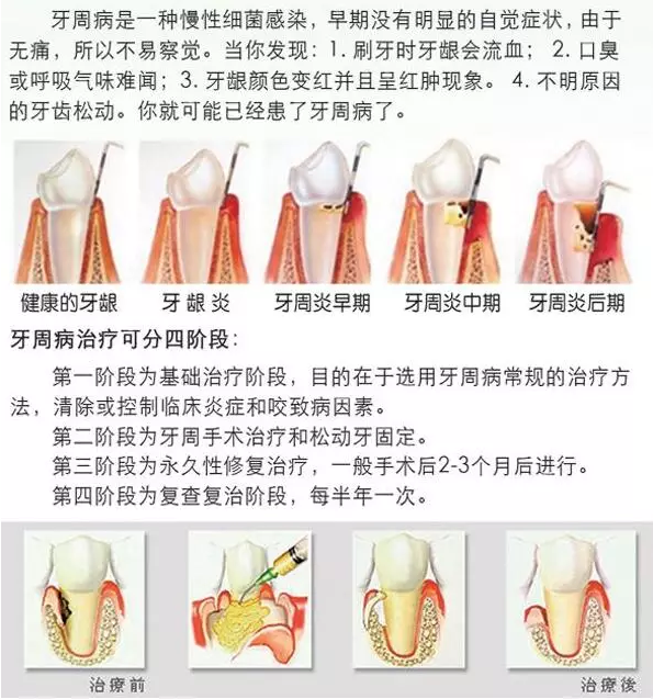 QQ截圖20170317143541.png