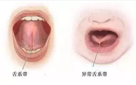 QQ截圖20170324162346.png QQ截圖20170324162346.png