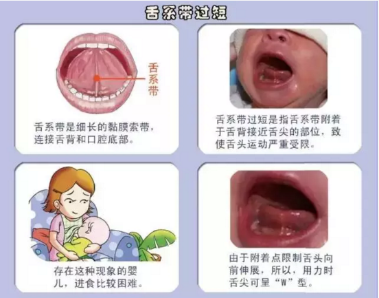 QQ截圖20170324162417.png QQ截圖20170324162417.png