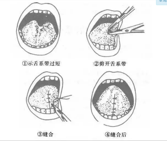 QQ截圖20170324162451.png QQ截圖20170324162451.png