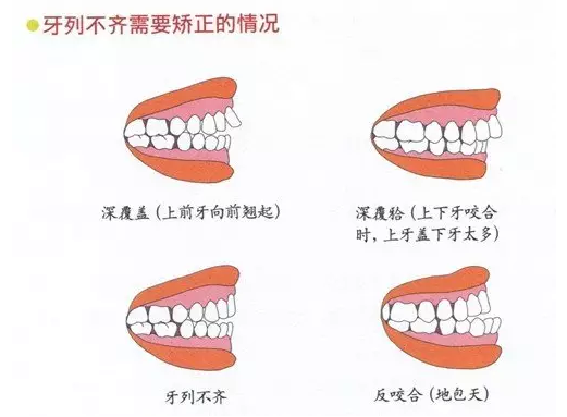 QQ截圖20170419162239.png