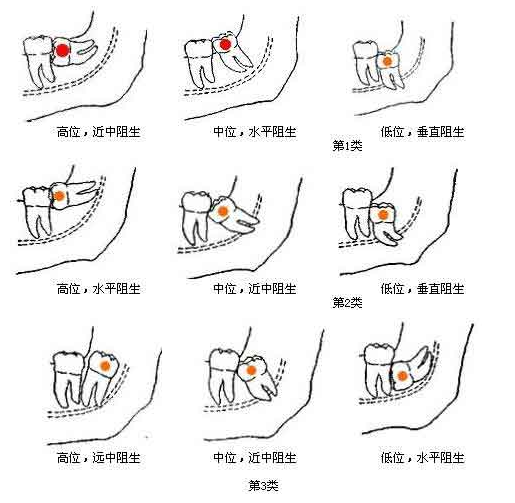 QQ截圖20170727164210.png