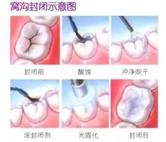 QQ截圖20171110152234.png