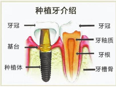 QQ截圖20171117135615.png